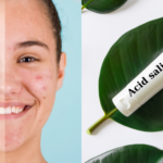 HOW TO USE SALICYLIC ACID IN AN ACNE SKINCARE ROUTIN?