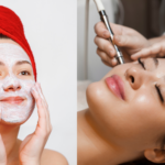 chemical peels and microdermabrasion